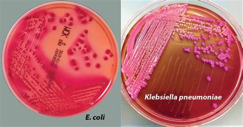 e coli macconkey agar results.